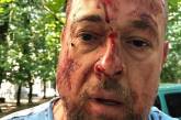 В Харькове жестоко избили активиста Нацкорпуса. ФОТО 18+