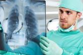 В первом квартале 2019 смертность от туберкулеза в Николаевской области выросла на 50%