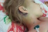 Николаевцев просят помочь девочке, которая упала с 3-хметровой высоты и сломала шею