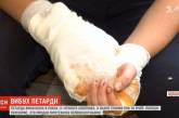 В Одессе в руках у ребенка взорвалась петарда: мальчик в больнице