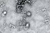 Появилось фото «китайского» коронавируса