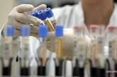 В Украине появятся тест-системы для диагностики коронавируса
