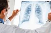 Больных туберкулезом в Украине будут лечить амбулаторно
