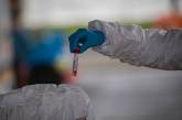 Вакцина от коронавируса может быть готова в сентябре, - вакцинолог Оксфорда