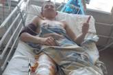 Во Львовской области 20-летнему парню врачи пришили отрезанную бензопилой ногу