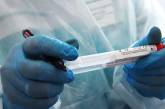 Количество зараженных коронавирусом в Украине выросло до 4 161 человека