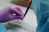 Николаевщина дороже всех в Украине закупила набор реагентов для ПЦР-тестов по выявлению коронавируса