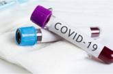 В Украине зафиксировано 12 331 случай COVID-19, из них 303 летальных