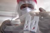 В МОЗ Украины объяснили, как и кому будут проводить тесты иммуно-ферментного анализа