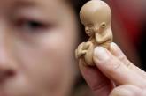 В Украине резко возросло число абортов