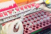 Украина заняла 47 место в антирейтинге стран по заболеваемости коронавирусом