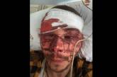 В Харькове жестоко избили битами сотрудника Партии Шария: пострадавший в реанимации. ФОТО 18+