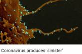 Ученые рассказали о «зловещих щупальцах» коронавируса