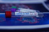 Количество больных COVID-19 в мире превысило 48 млн