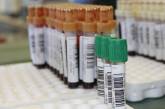 Ляшко назвал цену для украинцев на вакцину от коронавируса