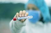 Ученые выяснили, когда пандемия коронавируса в мире пойдет на спад