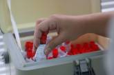 В Украине разработали сверхчувствительный «антигенный» тест на COVID-19