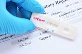 Николаевская область получит 23 тысячи экспресс-тестов на коронавирус