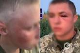 Одного из участников нападения на пограничников в Сумской области оформили «свидетелем»