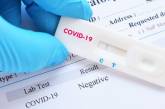 Ляшко заявил, что после вакцинации от COVID-19 сдавать анализ на антитела не надо