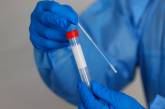 Как правильно пройти тест на коронавирус в Николаеве: что нужно соблюдать