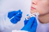 Наличие антител к коронавирусу не является основанием для отказа от вакцинации, - Минздрав