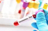 Медики назвали главную ошибку, которая допускается при экспресс-тестировании на коронавирус