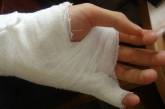 В Николаеве в день влюбленных пьяный посетитель клуба сломал девушке руку