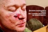 Солист известной украинской группы ранен под Киевом