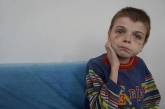 В Николаевской области сиротам «зажали» помощь от государства: на чиновников подали в суд