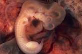 Британські вчені вперше виростили зі стовбурових клітин мишей ембріони