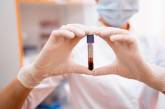 Лікарі попереджають про пік захворюваності на коронавірус в Україні