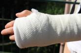 На Житомирщині мати зламала синові руку: посварилися через різні політичні погляди