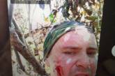 Член виконкому Миколаївської міськради потрапив під обстріл на фронті (фото)