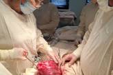 У Миколаєві лікарі провели унікальну операцію: видалили пухлину вагою майже 2 кг (фото)