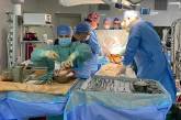 З початку року в Україні проведено понад 400 пересадок органів
