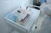 Гепатит А у Вінницькій області: кількість випадків захворювання зросла