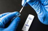 В Украине зафиксирован первый случай варианта коронавируса «Пирола», – Минздрав