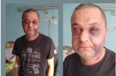 В Николаевской области полиция проверяет вероятный факт избиения жителя в ТЦК