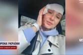 Враг повторно ударил по Запорожью: ранены журналисты (видео)