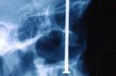 Несколько случаев из  «жизни» рентгена, который видел некоторый ужас (ФОТО)