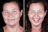 Бразильский дантист ездит по миру, чтобы дарить людям новые улыбки