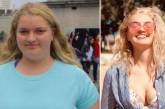 Девушка сбросила 63 кг, изменив поход к питанию: как она выглядит сейчас. (ФОТО)