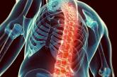Борьба с остеопорозом: как сделать кости более крепкими