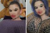 Девушка увеличила губы 26 раз: во что превратилось ее лицо. (ФОТО)