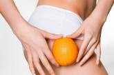 Целюліт: правила профілактики та боротьби з «апельсиновою кіркою»
