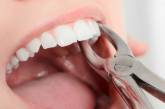 Вырвать нельзя сохранить: в каких случаях удаление зуба целесообразно?