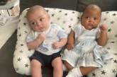 Британка родила близнецов с разным цветом кожи (ФОТО)