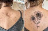 Люди показали, как с помощью татуировок изъяны кожи превратили в украшение (фото)