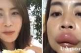 Жінка знайшла природний спосіб збільшити губи та насмішила мережу (відео) 